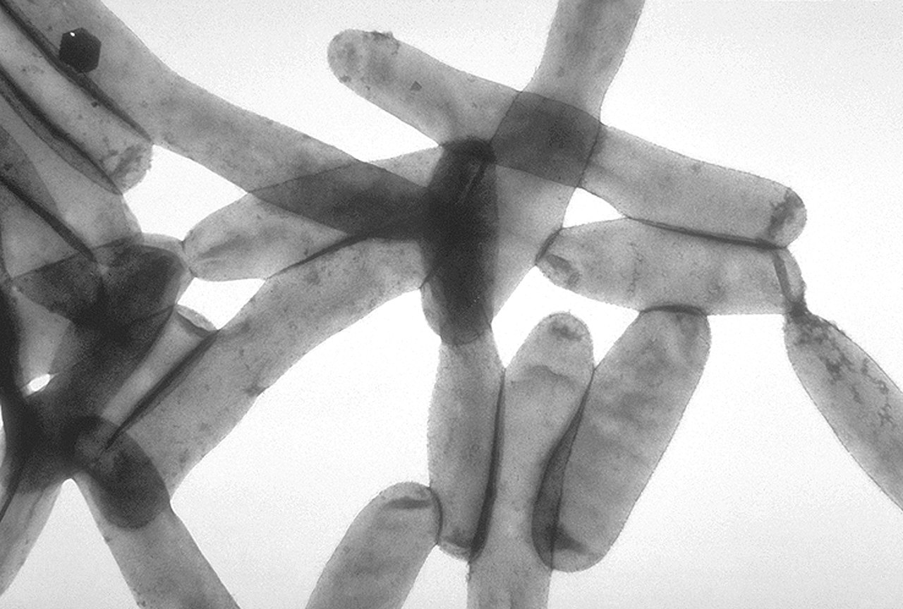 Legionella pneumophila. Джерело: CDC Public Health Image Library