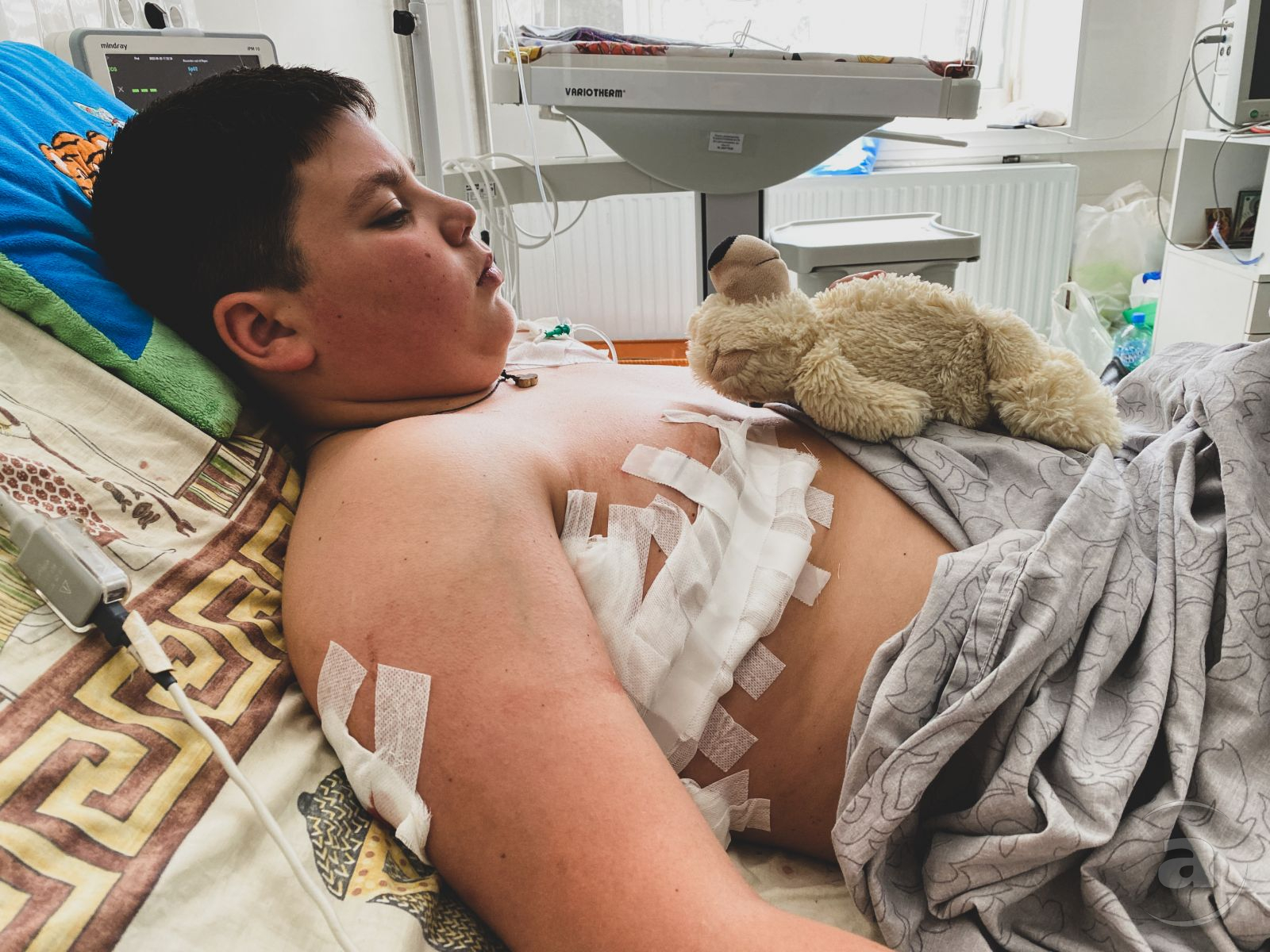 12-річний Гліб з Немишлянського району переніс операцію на серці. Уламок прошив легеню і потрапив у серце. Медики вирішуватимуть, чи вилучати його