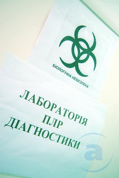 Зображення до:  В СЭС презентовали возможности новой лаборатории. Свиным гриппом здесь не ограничатся