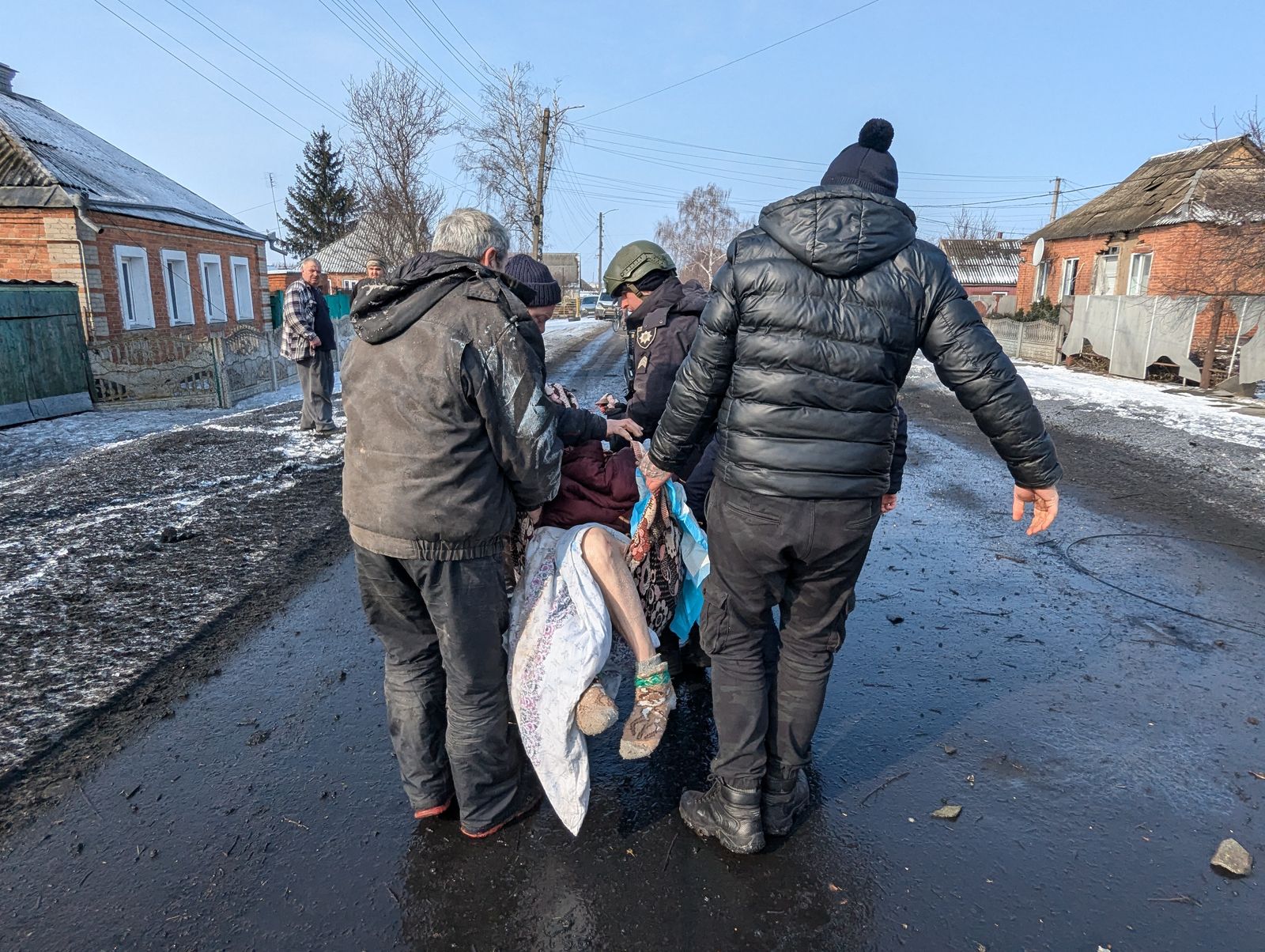 Зображення до:  Постраждалих від удару по Золочеву побільшало до пʼяти: фото