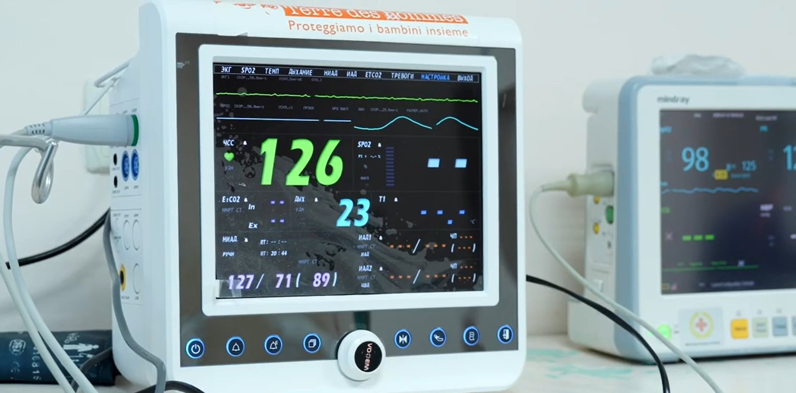 Зображення до:  Дитина, поранена від обстрілу Шевченківської громади, в тяжкому стані — ОВА