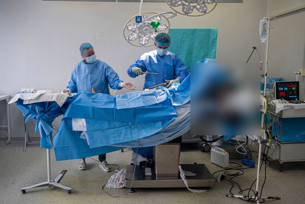 Зображення до:  Граната застрягла в нозі: у Харківському шпиталі розповіли про операцію за участі саперів